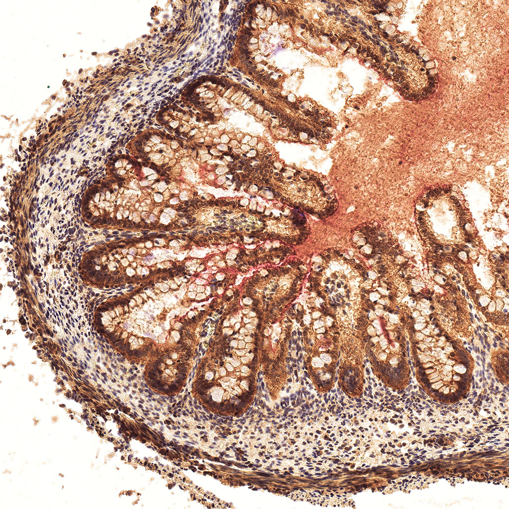 sars-cov-2 gene expression in a human fetus